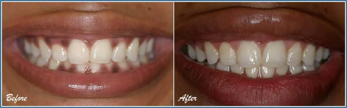 30304 avoid staining foods