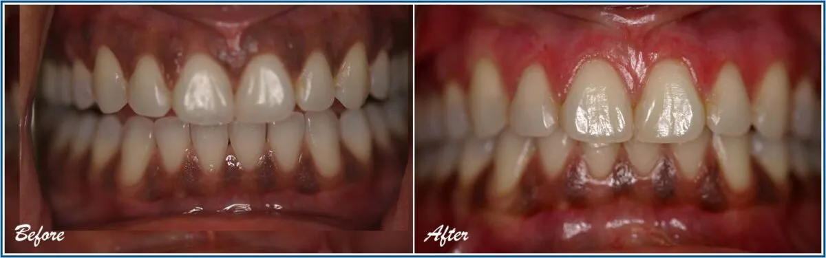 30304 dental check up