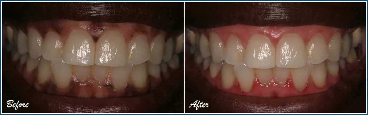 30304 proper oral hygiene