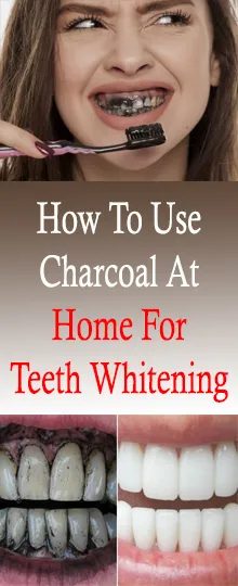 30306 rinsing mouth after charcoal