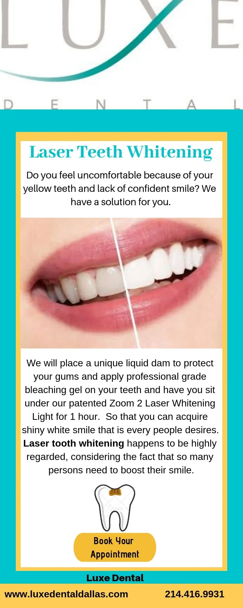 30314 coverage limitations tooth whitening