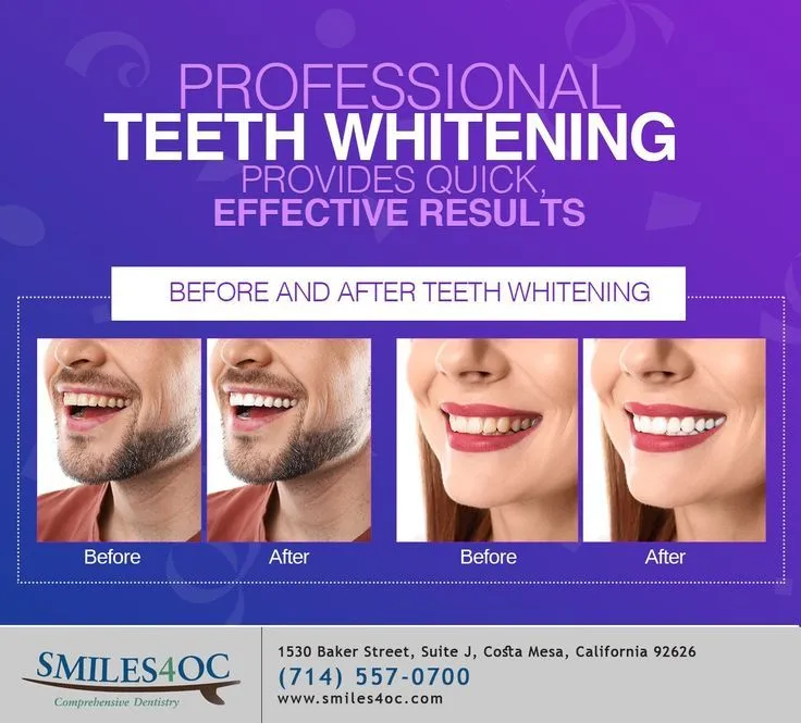 30314 dental insurance plans whitening