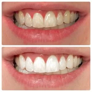30316 whitening toothpaste comparison