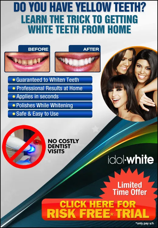 30319 idol teeth whitening at home