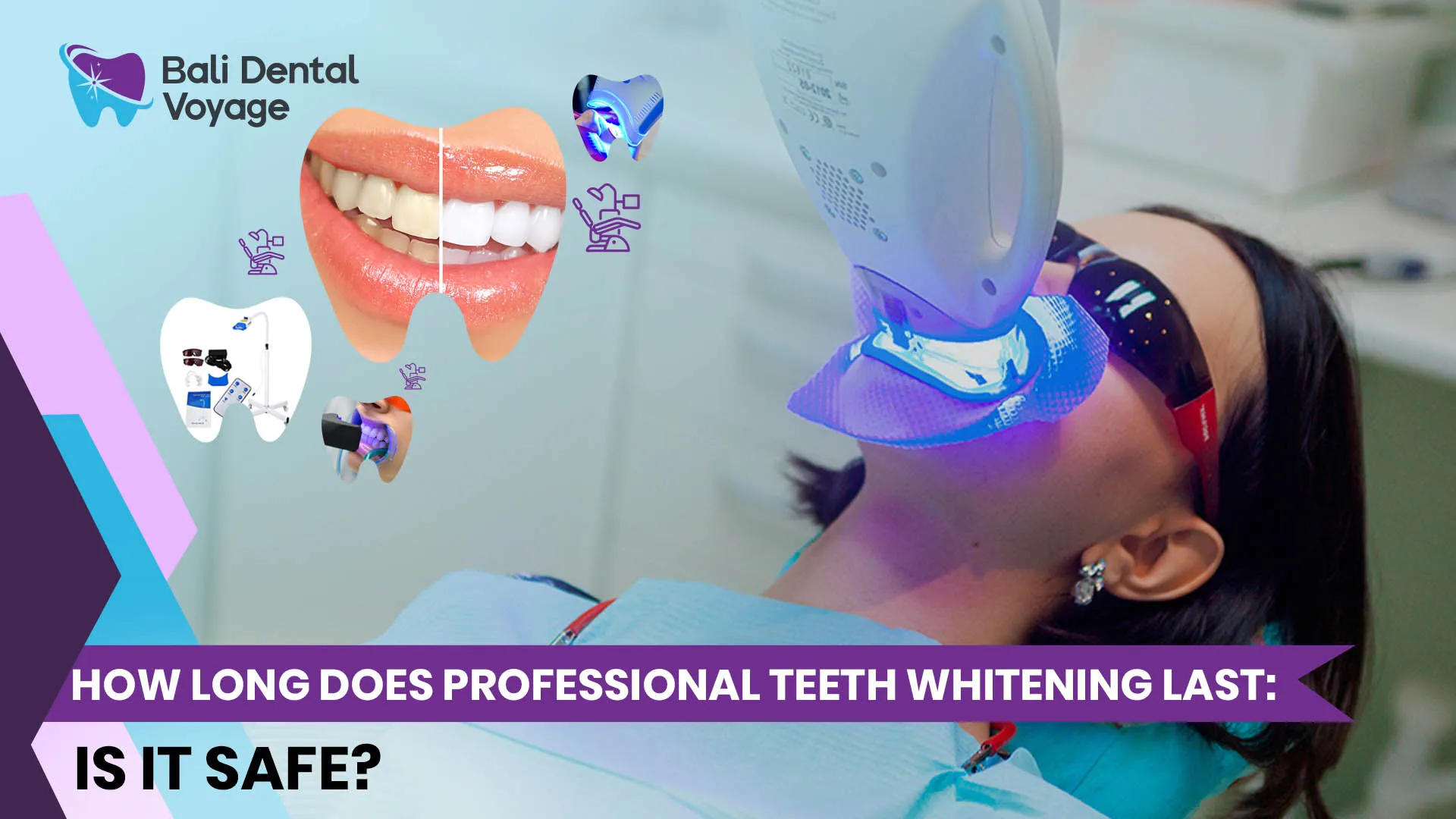 30322 teeth whitening procedure