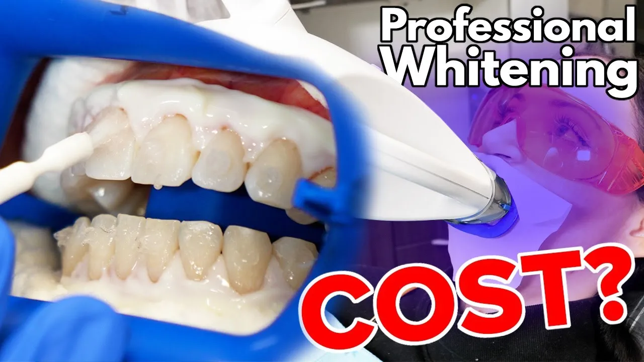 30329 teeth whitening before after