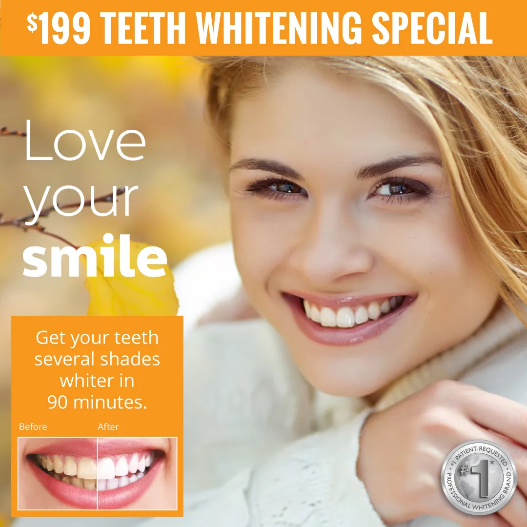 30339 teeth whitening frisco co smile