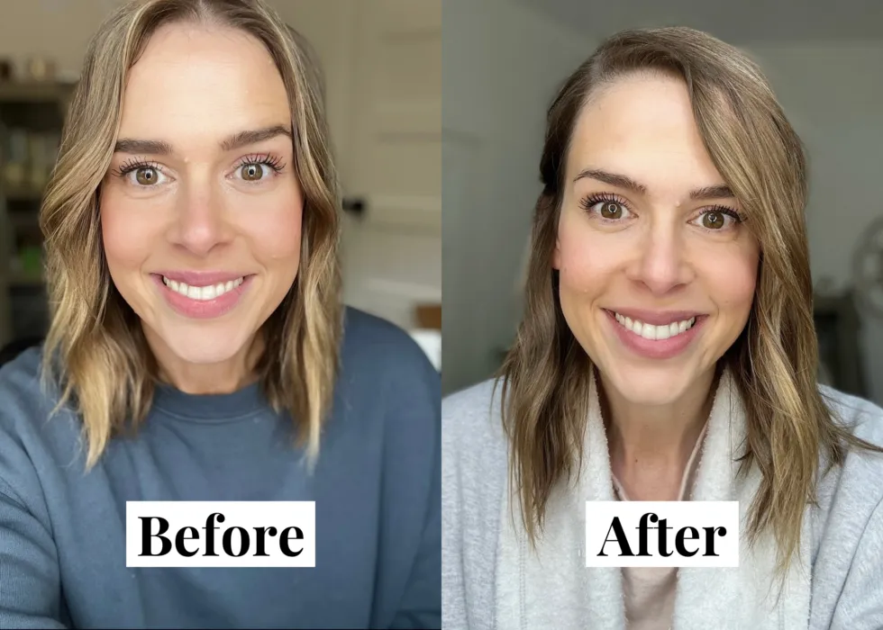 30340 lumineux whitening strips before after