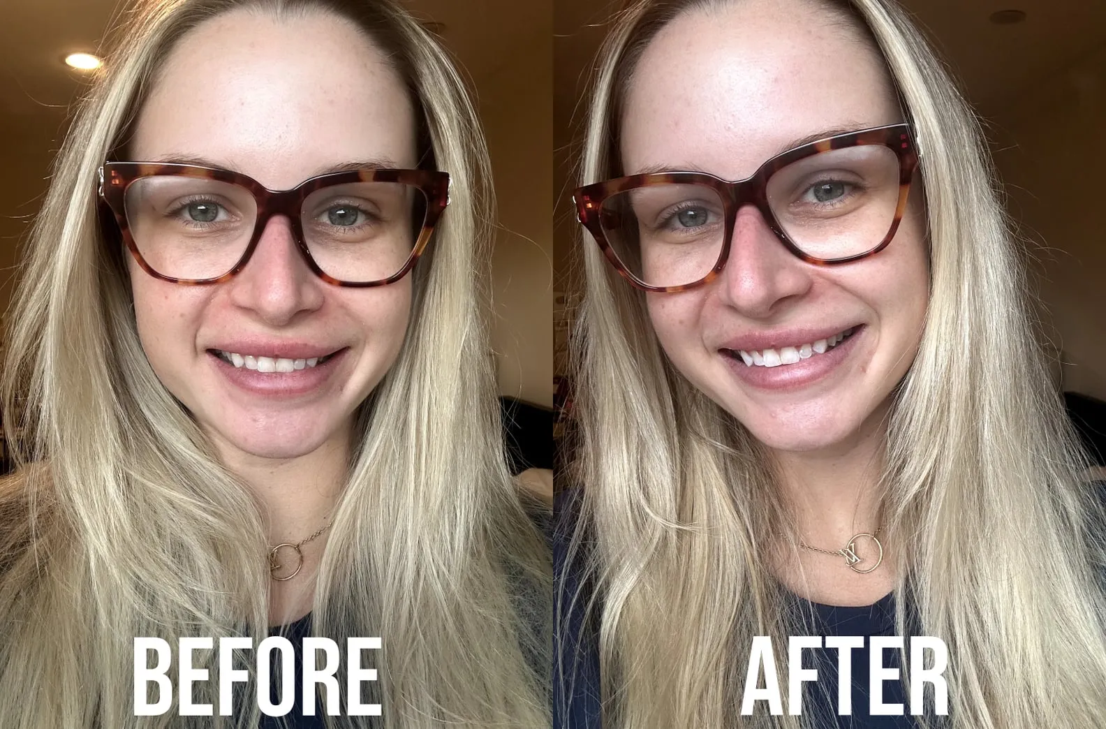 30340 lumineux whitening strips teeth sensitivity