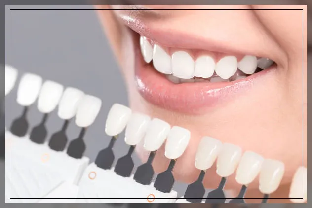 30342 teeth whitening saginaw mi image4