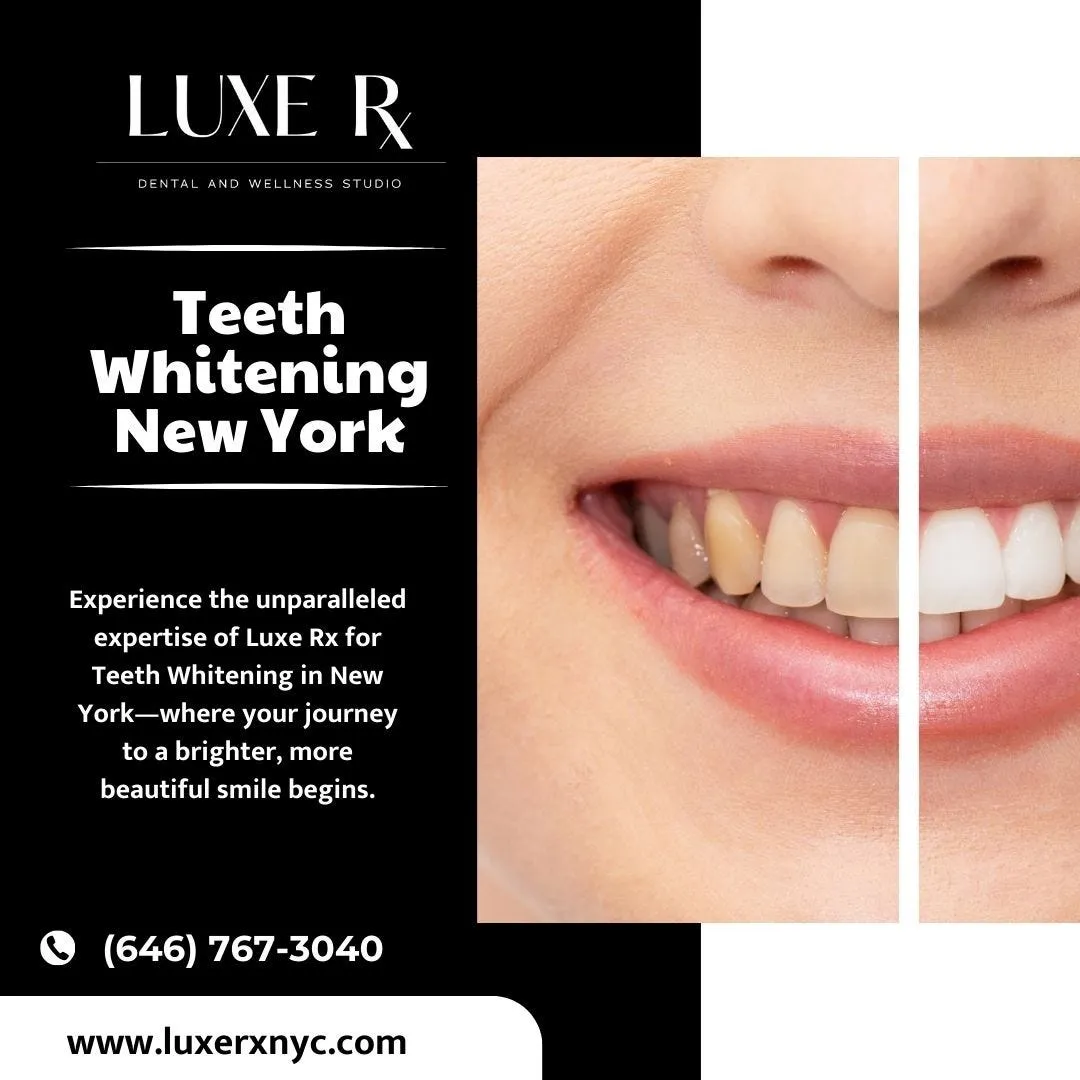 /img/30343-teeth-whitening-cost.webp