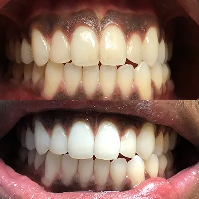 30348 staining foods drinks