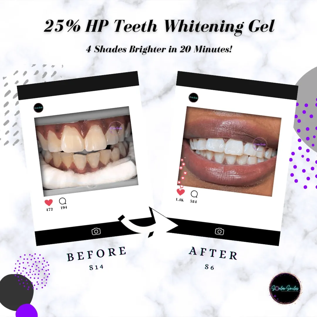 30354 professional whitening