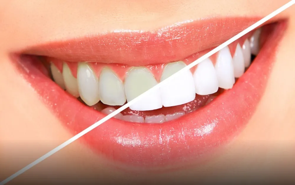 30358 dental checkup