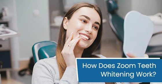 30363 teeth whitening comparison