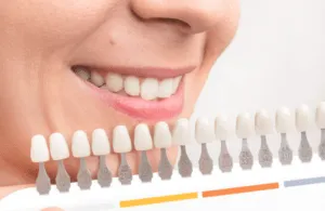 30366 teeth whitening safety