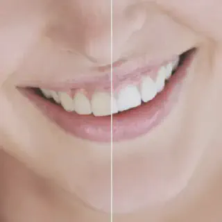 /img/30367-smile-enhancement-example.webp