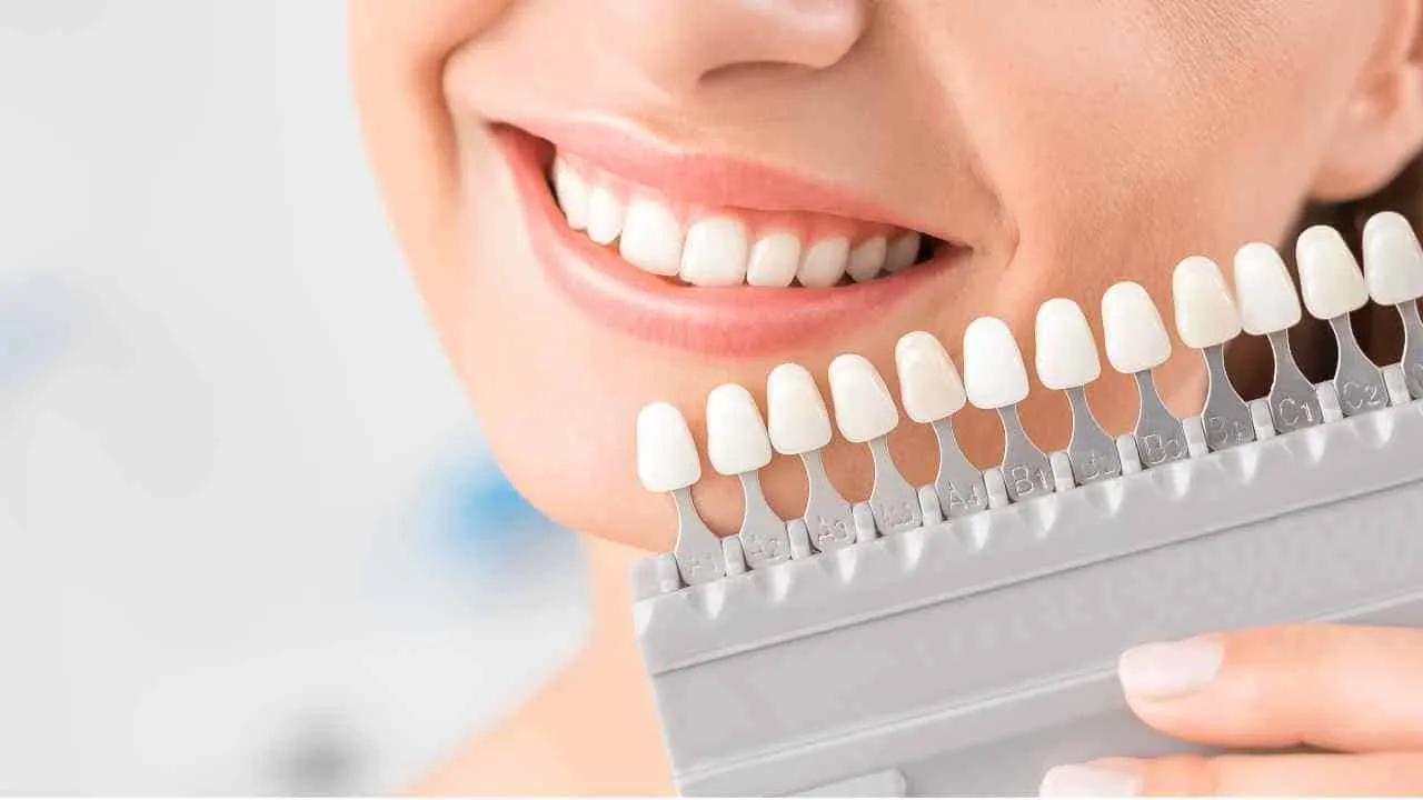 30369 teeth whitening insurance